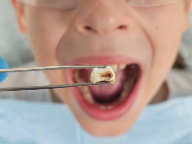 Best Emergency TMJ Treatment in Beecher, MI