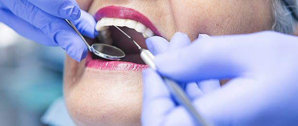Best Emergency Treatment for Dental Infections or Abscesses in Beecher, MI